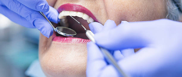 Best Emergency Dental Care for Broken or Chipped Teeth in Buckner, MO